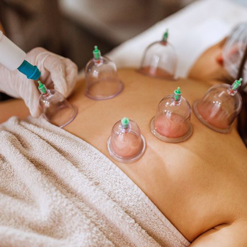 16554 cupping therapy